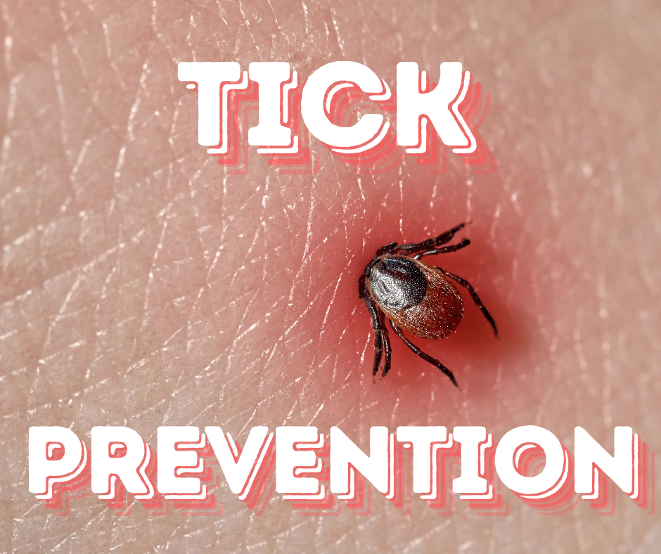 Tick Prevention